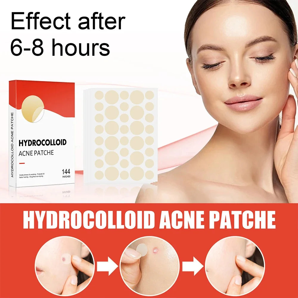 144pcs/set Face High-end Skin Care Pimple Acne Patches Professional Healing Absorbing Spot Sticker Covering for Covering Acne