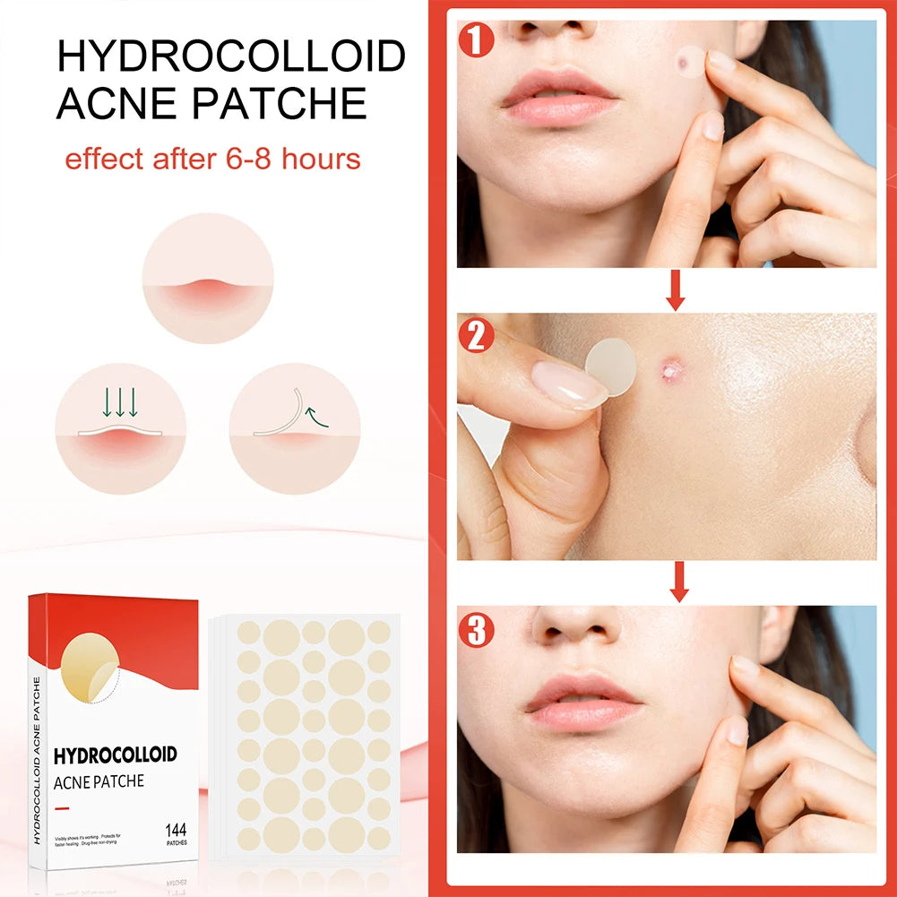 144pcs/set Face High-end Skin Care Pimple Acne Patches Professional Healing Absorbing Spot Sticker Covering for Covering Acne