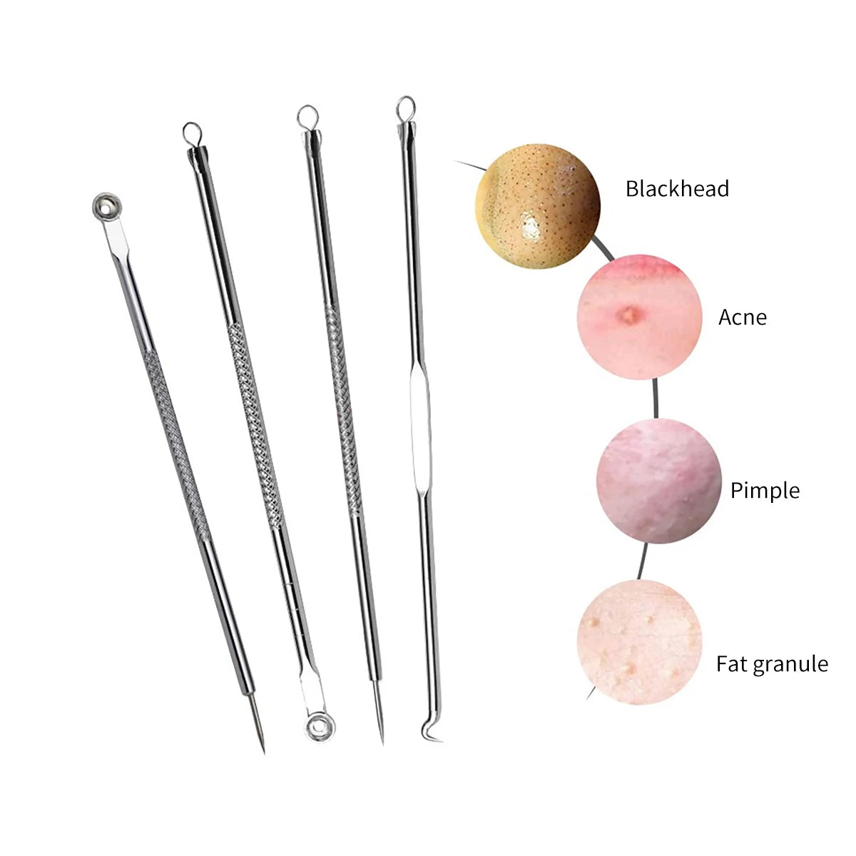 Acne Needle Remove Blackhead Blemish Pimple Comedone 4pcs/Set Double-ended Stainless Steel Facial Cleaning Skin Care