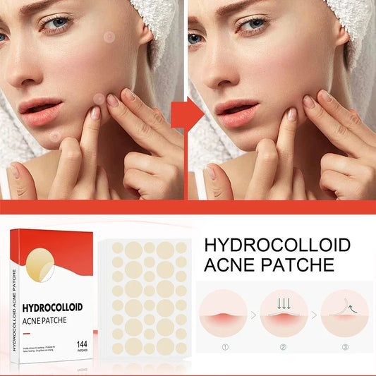 144pcs/set Face High-end Skin Care Pimple Acne Patches Professional Healing Absorbing Spot Sticker Covering  for Covering Acne