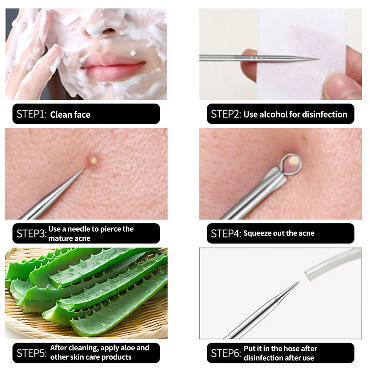 Acne Needle Remove Blackhead Blemish Pimple Comedone 4pcs/Set Double-ended Stainless Steel Facial Cleaning Skin Care