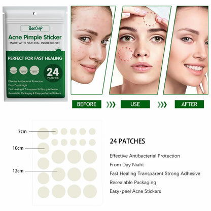 24/36pcs Hydrocolloid Acne Patch Blemish Stickers For Face And Skin Breathable Waterproof Gentle Non-Irritating Acne Stickers