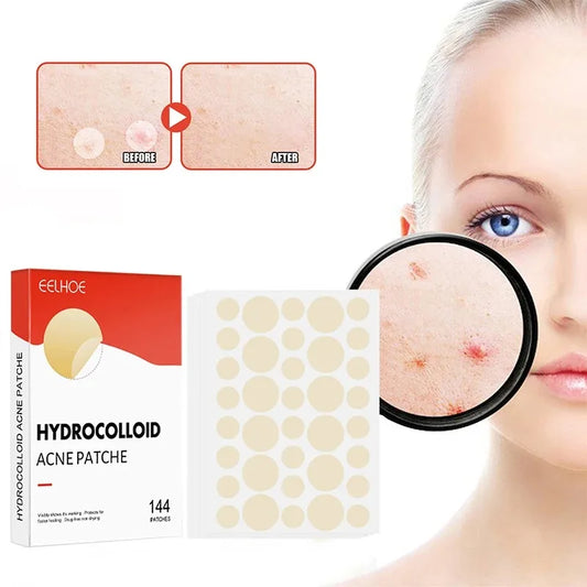 144pcs/set Face High-end Skin Care Pimple Acne Patches Professional Healing Absorbing Spot Sticker Covering  for Covering Acne