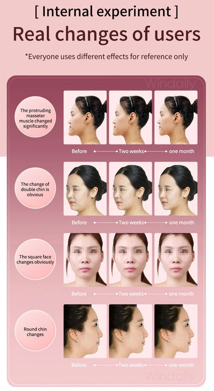 Facial Lifting Device LED Photon Therapy Facial Slimming Vibration Massager Double Chin V Face Shaped Cheek Lift  Belt Machine