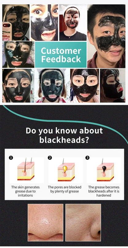 LANBENA Remove Blackhead Mask Shrinking Pore Deep Cleaning Mask Improve Rough Skin Acne Treatment Skin Brighteing Care Beauty