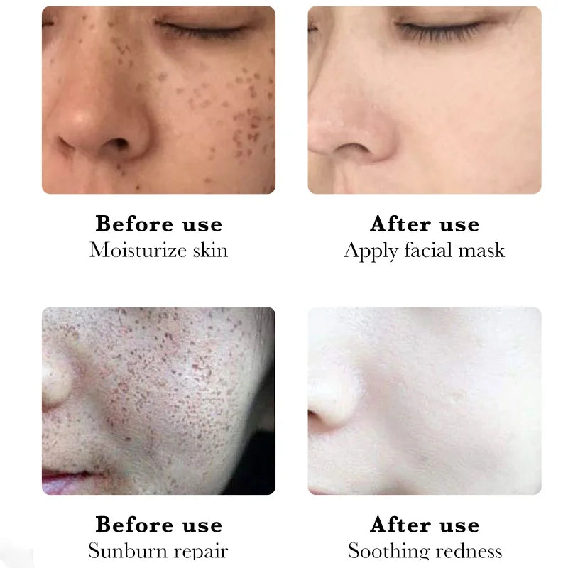 Dark Spot Removal Serum Effectively lightens and diminishes dark spots smoothen & refines the skin's texture Moisturizing Repair