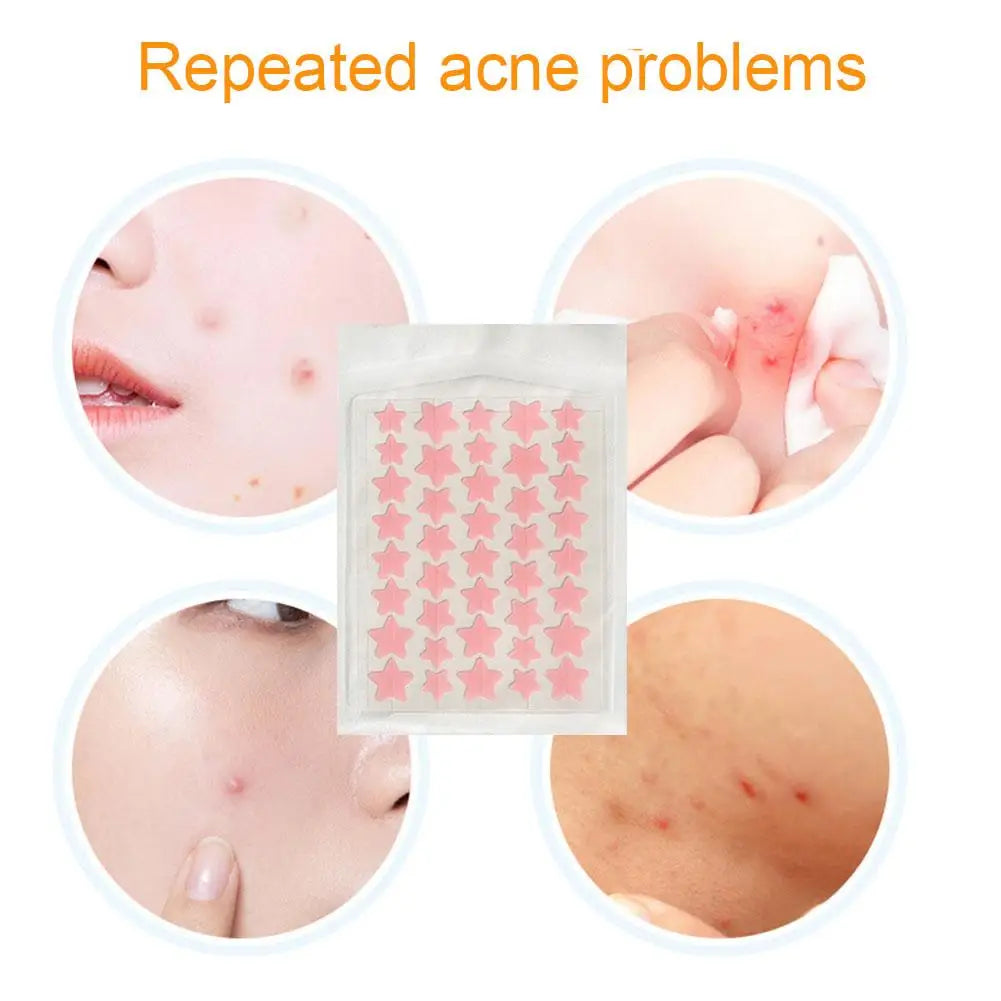35/40Pcs Colorful Cute Star Heart Shaped Acne Treatment Sticker Invisible Acne Cover Pimple Patch Skin Care