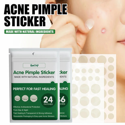 24/36pcs Hydrocolloid Acne Patch Blemish Stickers For Face And Skin Breathable Waterproof Gentle Non-Irritating Acne Stickers