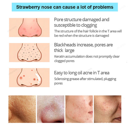 Unisex Deep Cleansing Nose Strips for Acne & Blackhead Removal Shrink Pore Nose Black Head Stickers Skin Care Patch