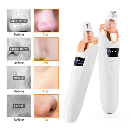Vacuum Nose Blackhead Remover Face Cleansing Beauty Machine Facial Suction Cleaner Pimple Dead Skin Remover Extractor Skin Care