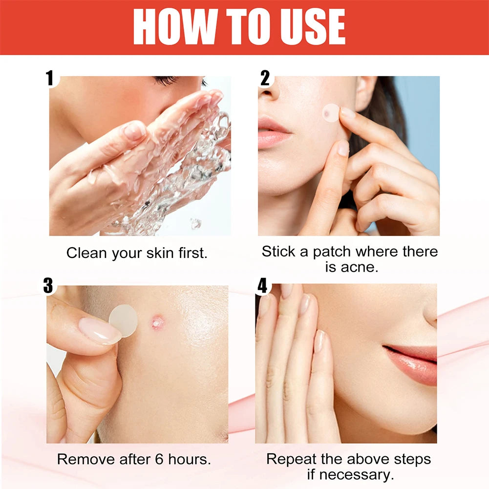 144pcs/set Face High-end Skin Care Pimple Acne Patches Professional Healing Absorbing Spot Sticker Covering  for Covering Acne