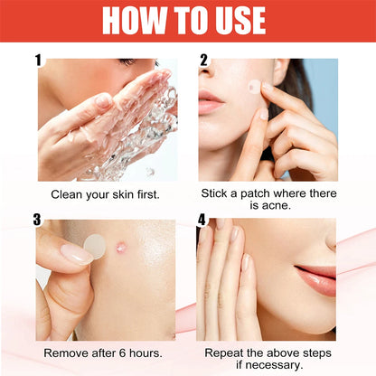 144pcs/set Face High-end Skin Care Pimple Acne Patches Professional Healing Absorbing Spot Sticker Covering  for Covering Acne