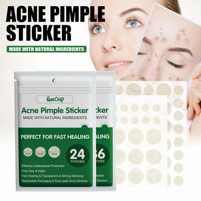 24/36pcs Hydrocolloid Acne Patch Blemish Stickers For Face And Skin Breathable Waterproof Gentle Non-Irritating Acne Stickers