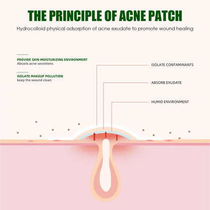 24/36pcs Hydrocolloid Acne Patch Blemish Stickers For Face And Skin Breathable Waterproof Gentle Non-Irritating Acne Stickers